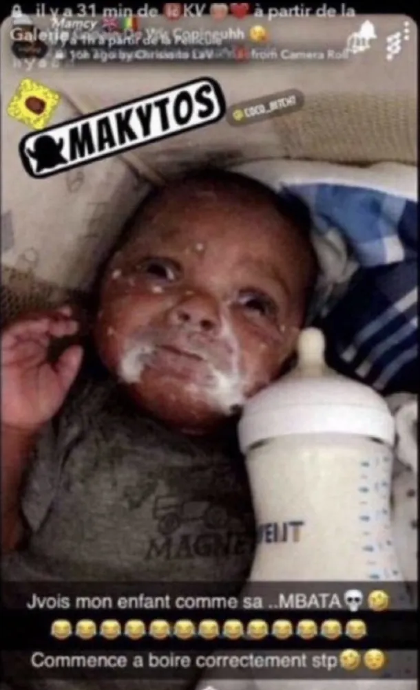 J'vois mon enfant comme ça... MBATA, commence à boire correctement déjà, bébé au regard traumatisé visage couvert de hlib, lait, sait pas utiliser un biberon, à renier de toute urgence